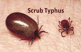 Scrub Typhus: